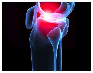 причины артрита коленного сустава 