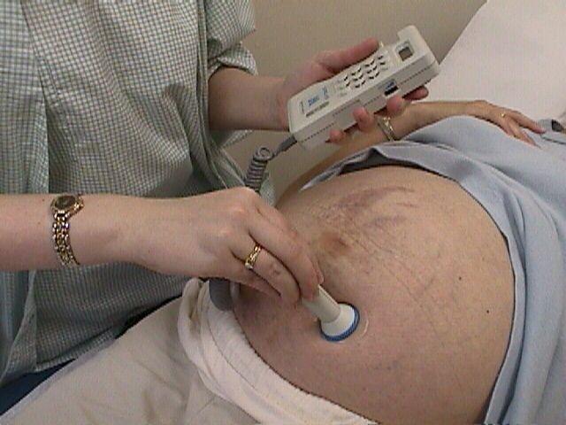 допплерометрия при беременности