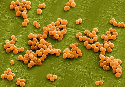 staphylococcus aureus норма