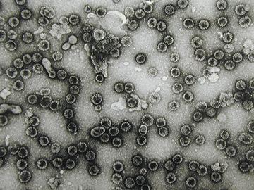 Папилломавирус человека лечение