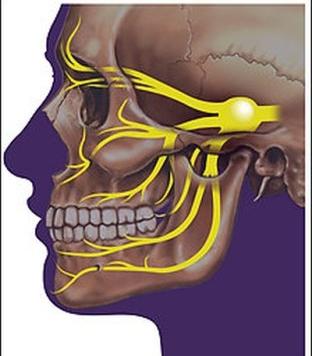 лицевой тройничный нерв 
