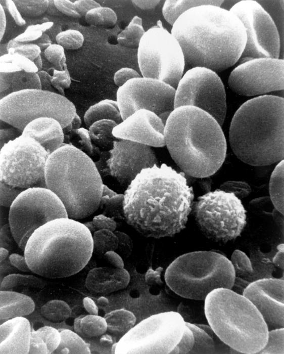 лейкоциты повышены лимфоциты понижены