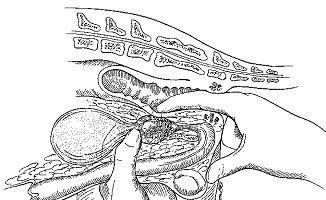  урологический массаж простаты