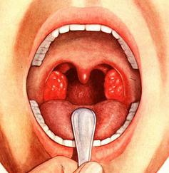 стрептоцид для лечения горла