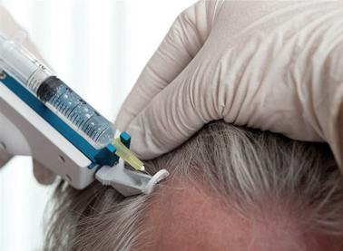 Мезотерапия для волос отзывы