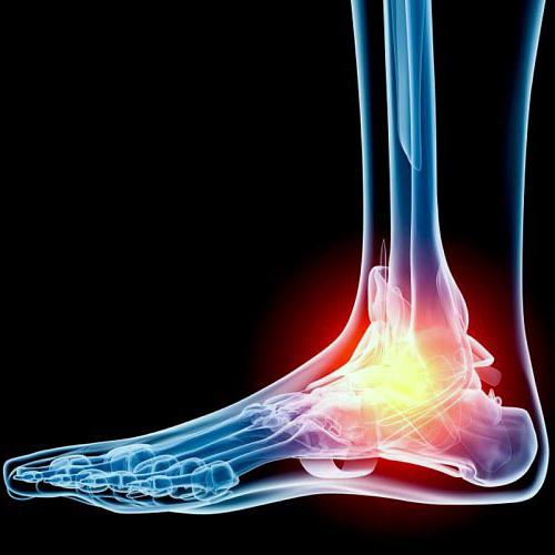 chimioterapie pentru dureri de genunchi artrita tratamentul articulației genunchiului