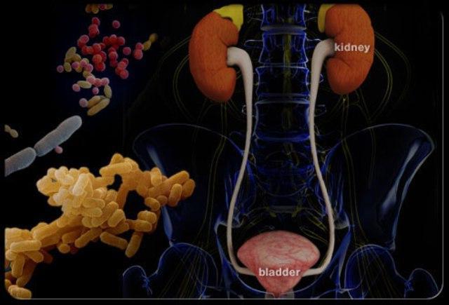 инфекция мочевыводящих путей у мужчин