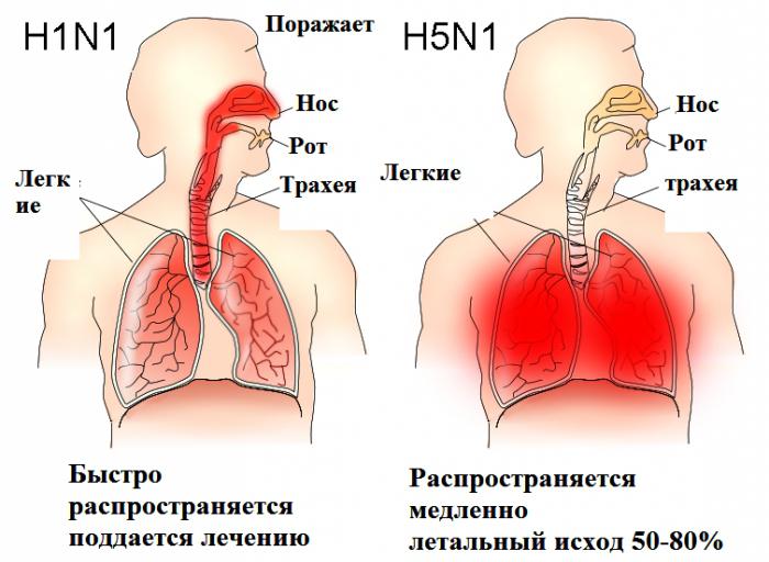 птичий грипп симптомы