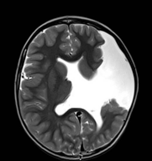 магнитная томография головного мозга