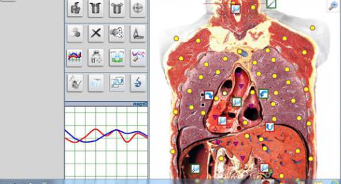 Компьютерная биорезонасная диагностика состяния организма
