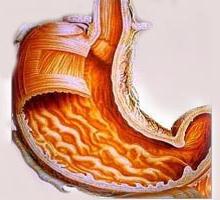 поверхностный рефлюкс гастрит