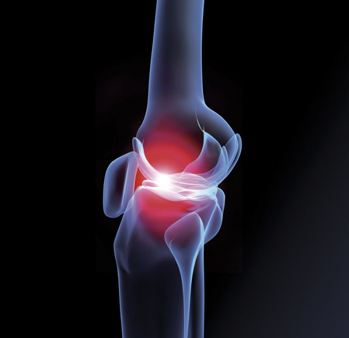 воспаление коленного сустава симптомы