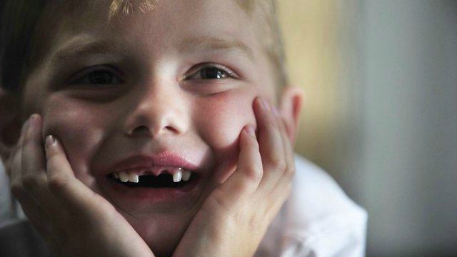 фторирование зубов у детей 