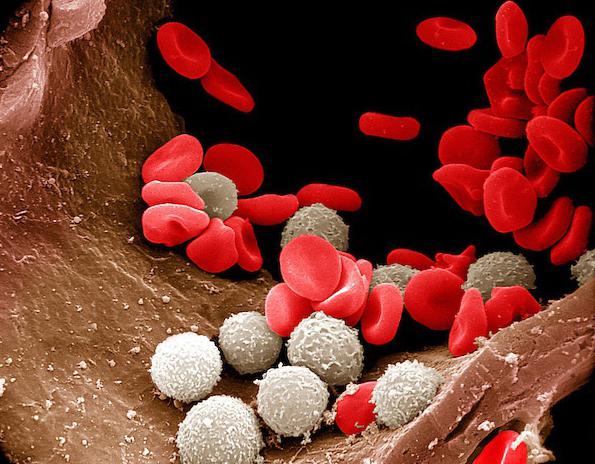повышение лейкоцитов в крови причины