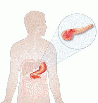 недостаток ферментов поджелудочной железы