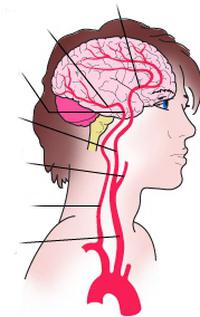 нарушение кровоснабжения головного мозга