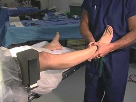 операция артроскопия коленного сустава отзывы