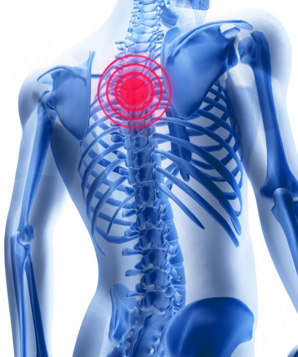 лечение остеохондроза грудного отдела позвоночника