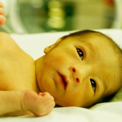 желтушка у новорожденных норма билирубина