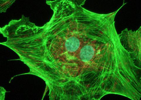 Строение клетки клеточная мембрана ядро