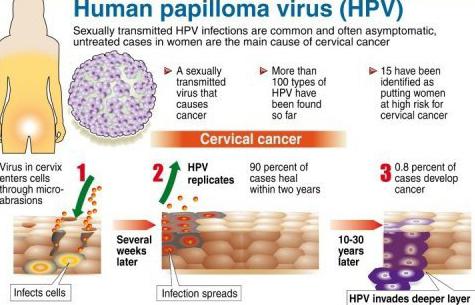 папилломавирусная инфекция фото