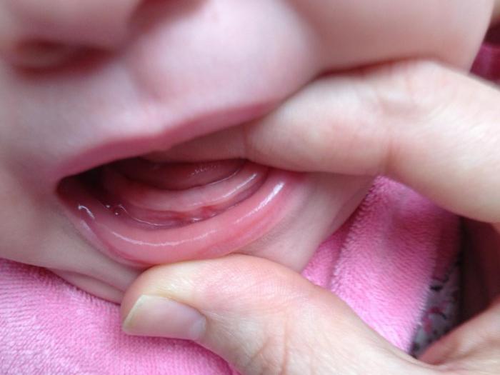 режутся зубы как помочь ребенку отзывы