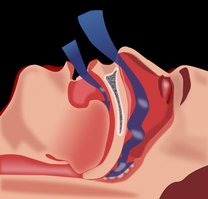 почему человек начинает храпеть