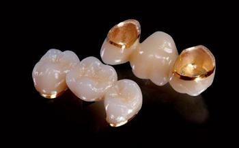 зубы металлокерамика москва