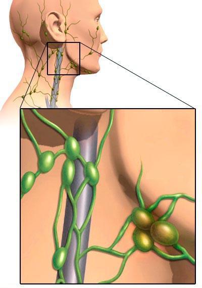 увеличенные лимфоузлы на шее у ребенка лечение