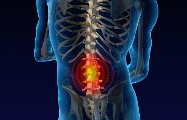 дегенеративно дистрофические изменения поясничного отдела позвоночника