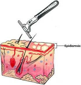 сильное раздражение после бритья на ногах