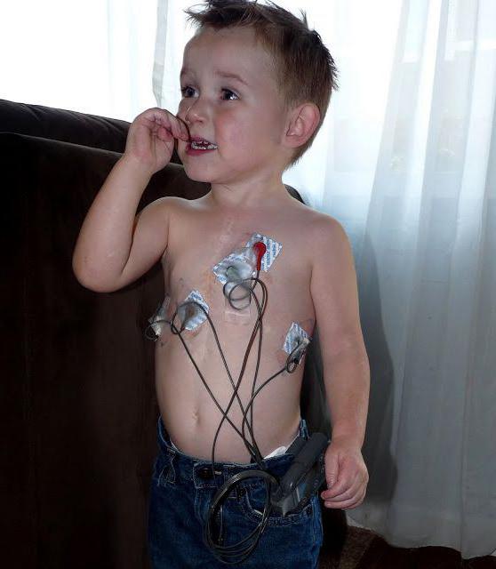 Суточный мониторинг сердца ребенку