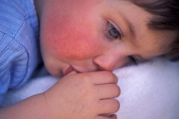 высокая температура у ребенка и красное горло