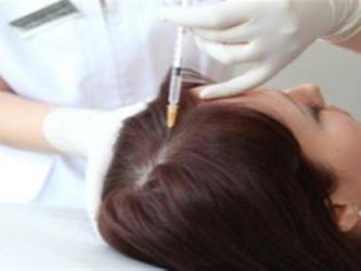 лечение волос плазмолифтингом 