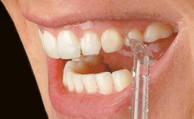 Как пользоваться ирригатором для полости рта