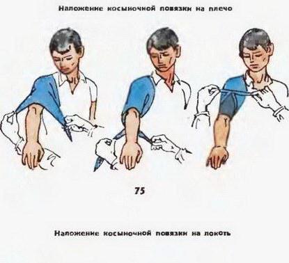 техника наложения окклюзионной повязки 