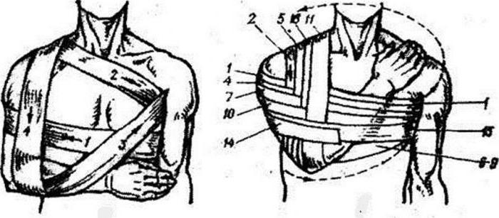 повязка на плечевой сустав