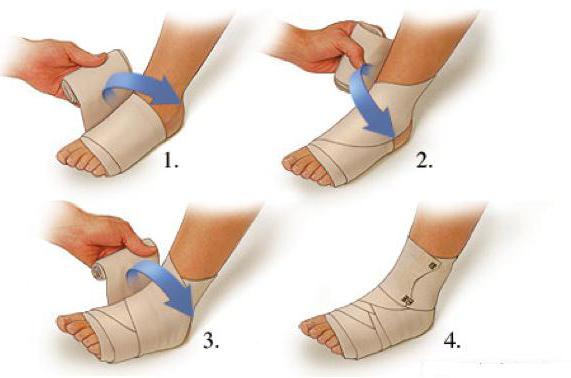 техника наложения повязок