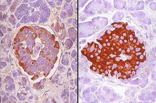 островки лангерганса вырабатывают