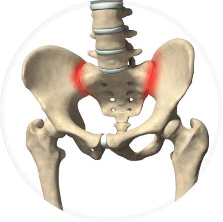 сакроилеит причины 