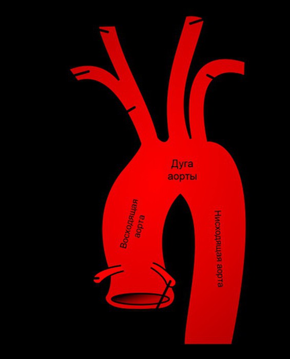 брахиоцефальная артерия 