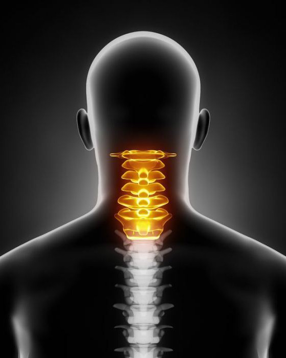 остеохондроз шейного отдела позвоночника с протрузиями дисков