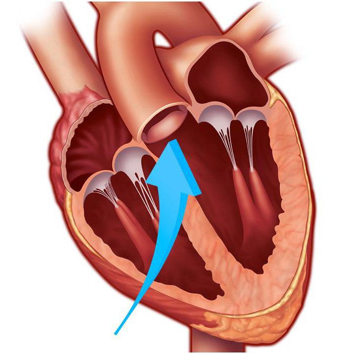 Створки аортального клапана
