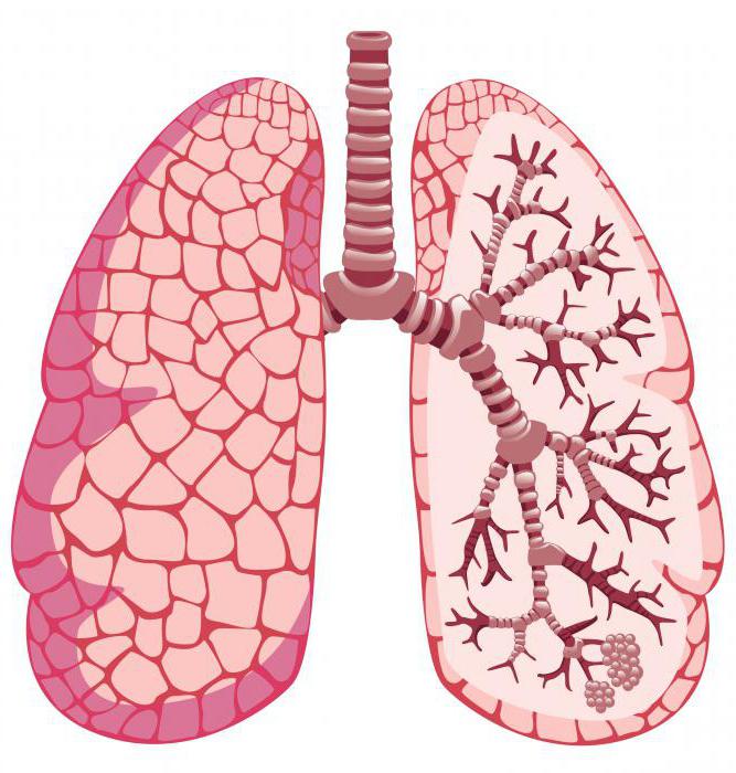 неотложная доврачебная помощь при приступе бронхиальной астмы
