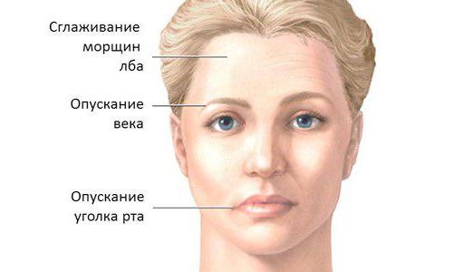 мелькерссона розенталя синдром