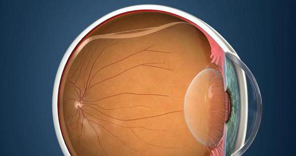 разрыв сетчатки глаза операция