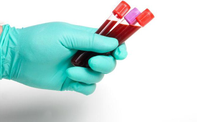 алгоритм действия забора крови из вены 