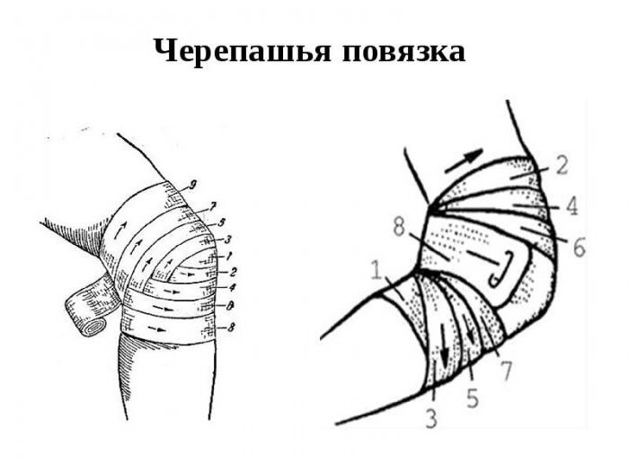 черепашья повязка