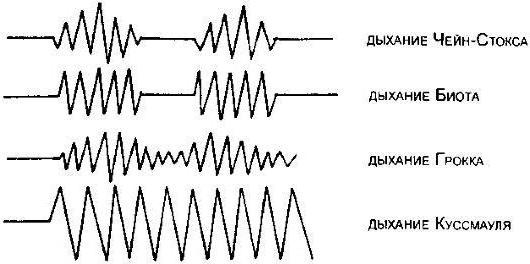 Основные виды дыхания