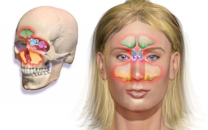 препараты при синусите